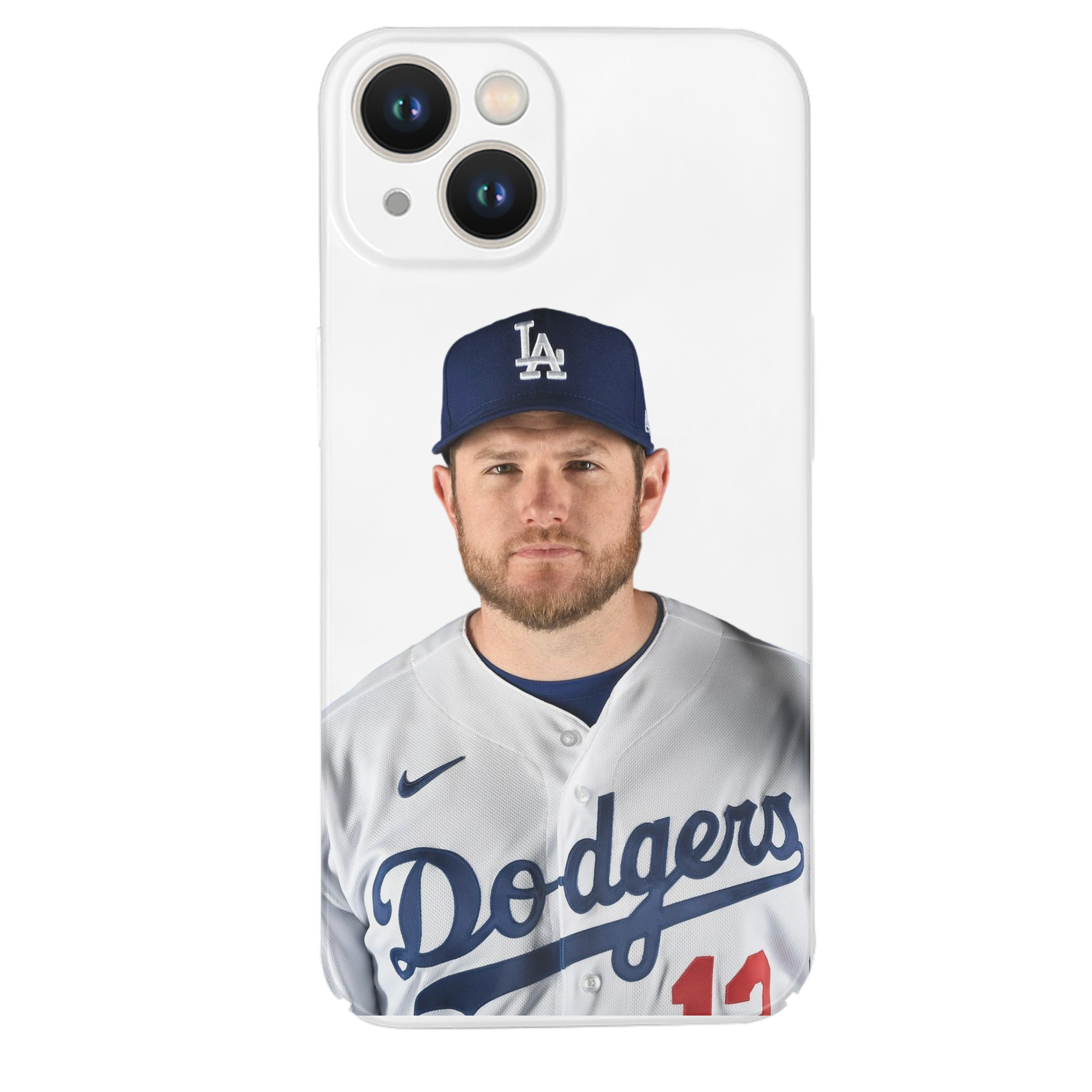  IPhone 14 Series Full-Cover Hard Case – Shockproof With Raised Camera Protection – Precise Cutouts, Wireless Charging Compatible – Durable, Anti-Yellowing, Easy To Clean